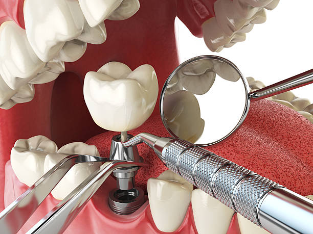Best Emergency Dental Care for Broken or Chipped Teeth in Muskegon, MI