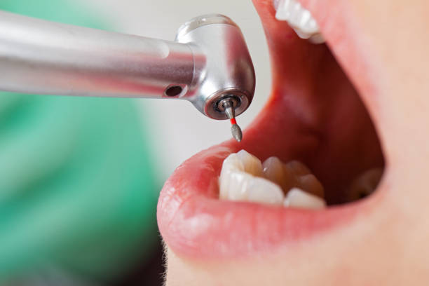 Best Emergency Tooth Extraction in Muskegon, MI